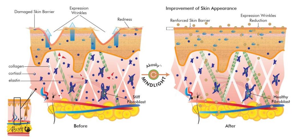 akosky mindlight mechanism of action