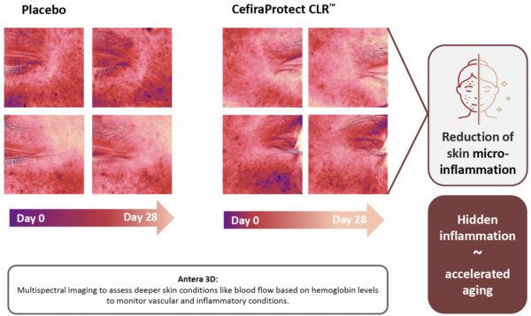 cefiraprotect clr redness and microinflammation improvement