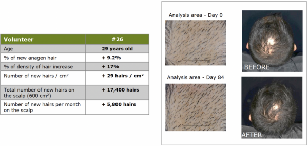 redensyl thicker hair details