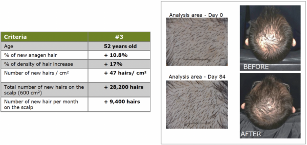 redensyl visible scalp redensification details