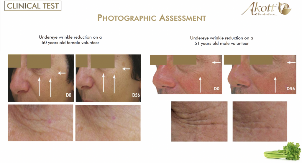 akosky apium clinical test wrinkle reduction