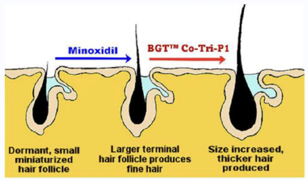 bgt co tri p1 hair growth