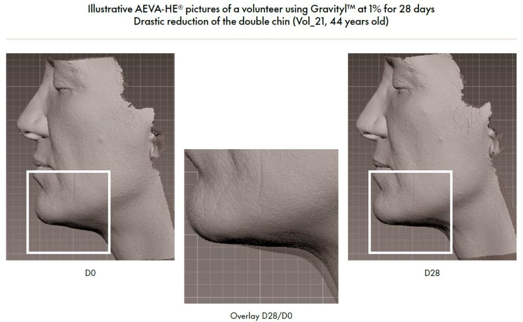 gravityl clinical study 2 improving skin elasticity and firmness image