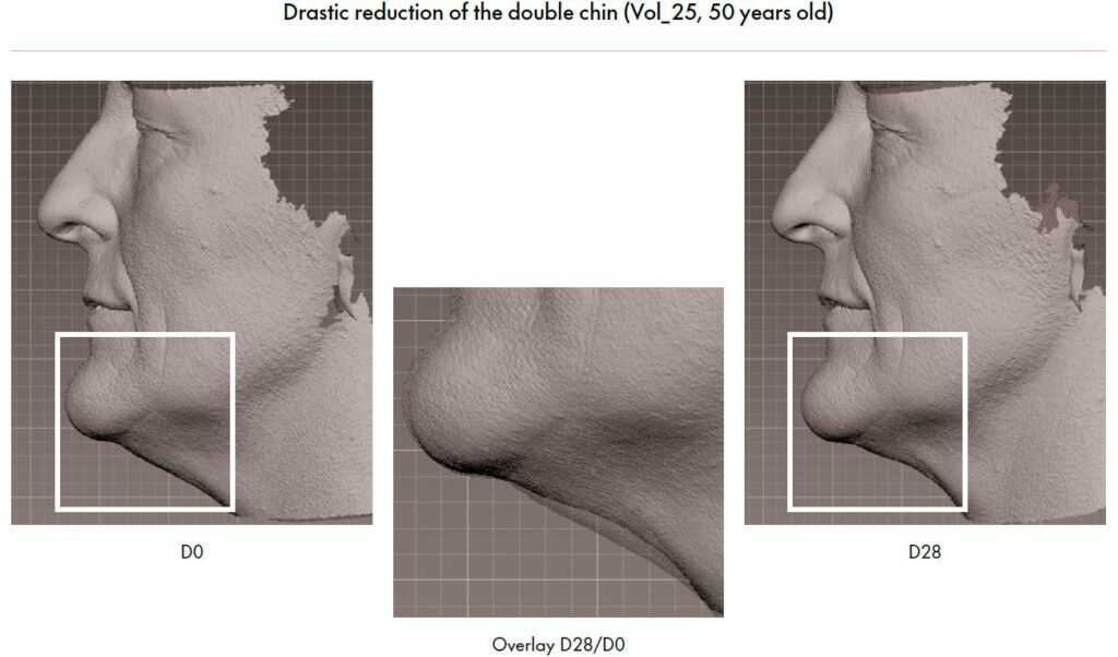 gravityl clinical study 2 improving skin elasticity and firmness image 2