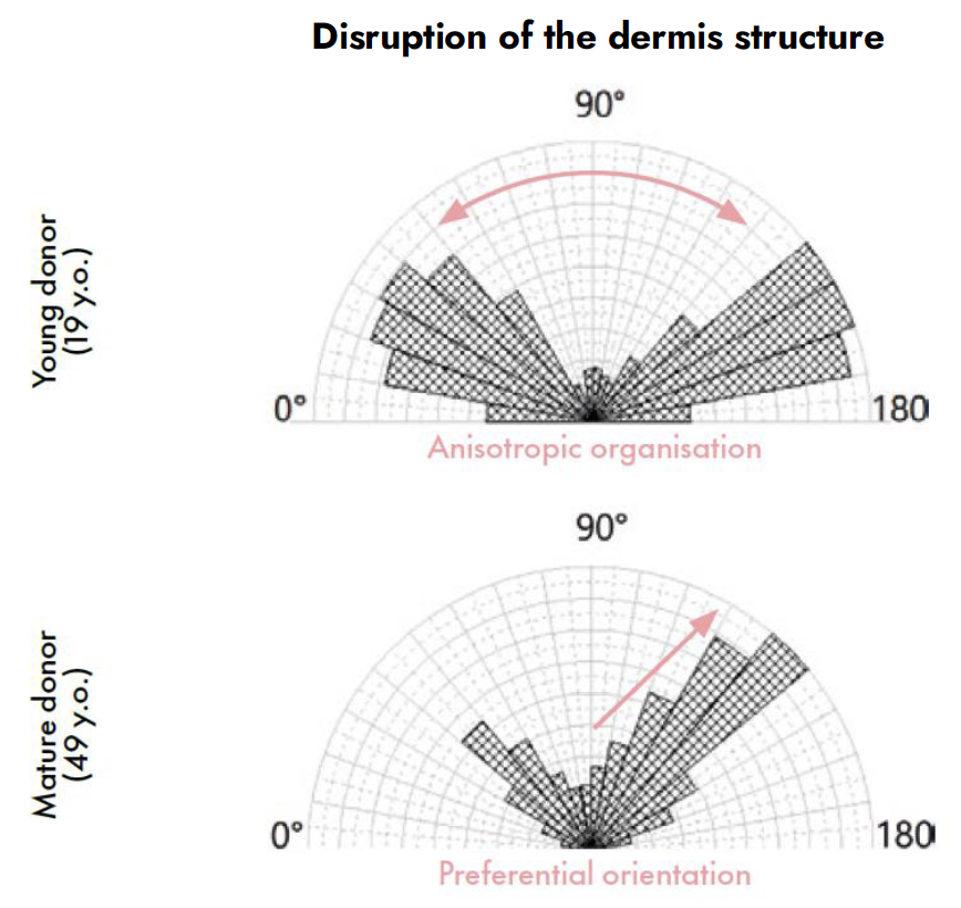 gravityl disruption of the dermis structure