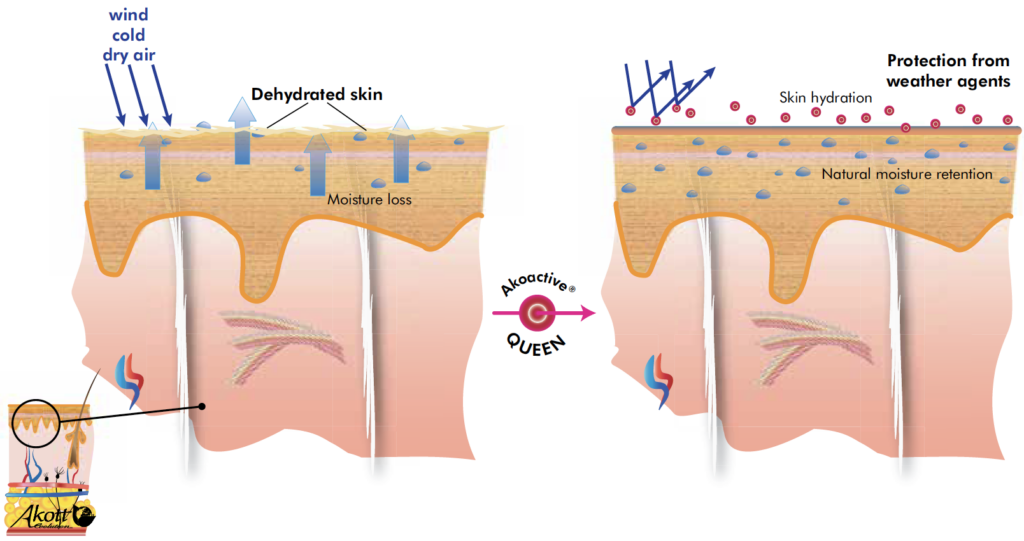 akoactive queen mechanism of action