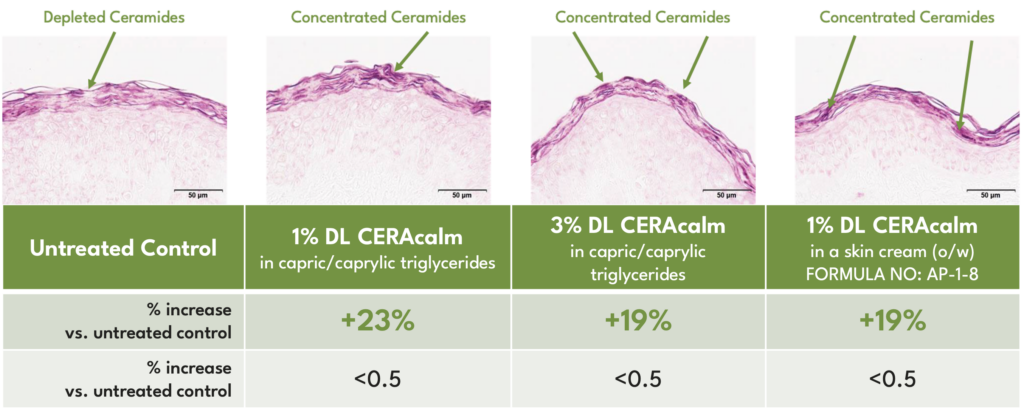 dl ceracalm barrier repair ceramides