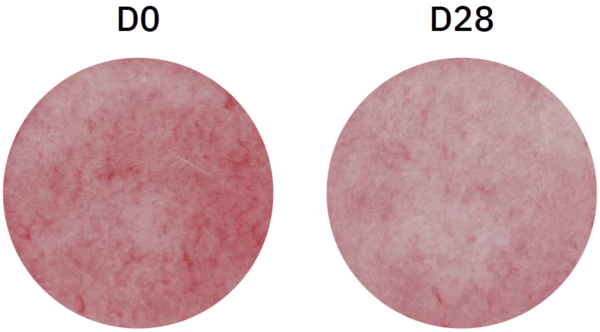 sens'flower clinical study redness